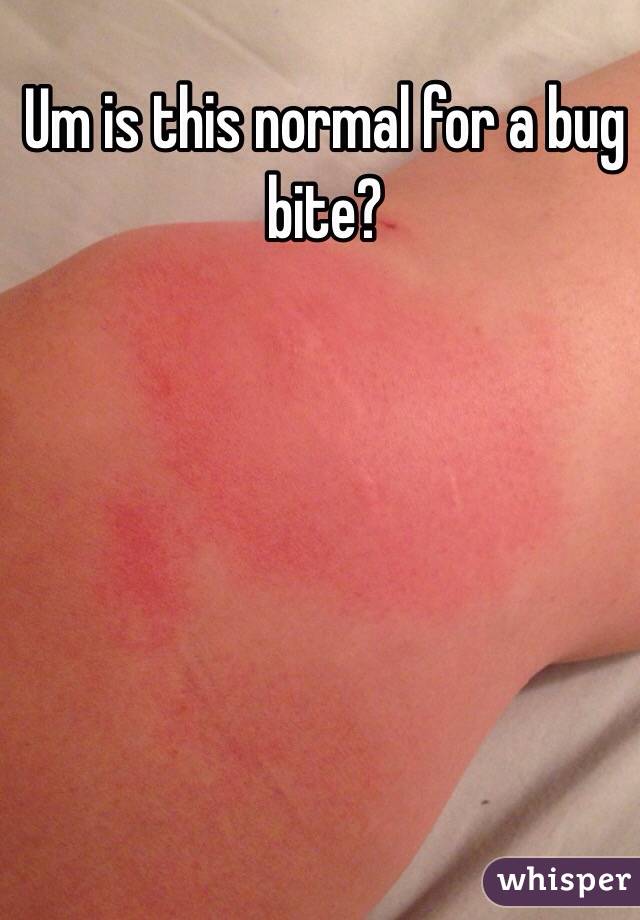 Um is this normal for a bug bite?