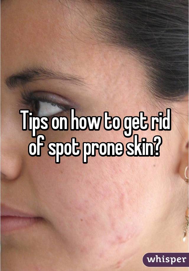 Tips on how to get rid of spot prone skin?