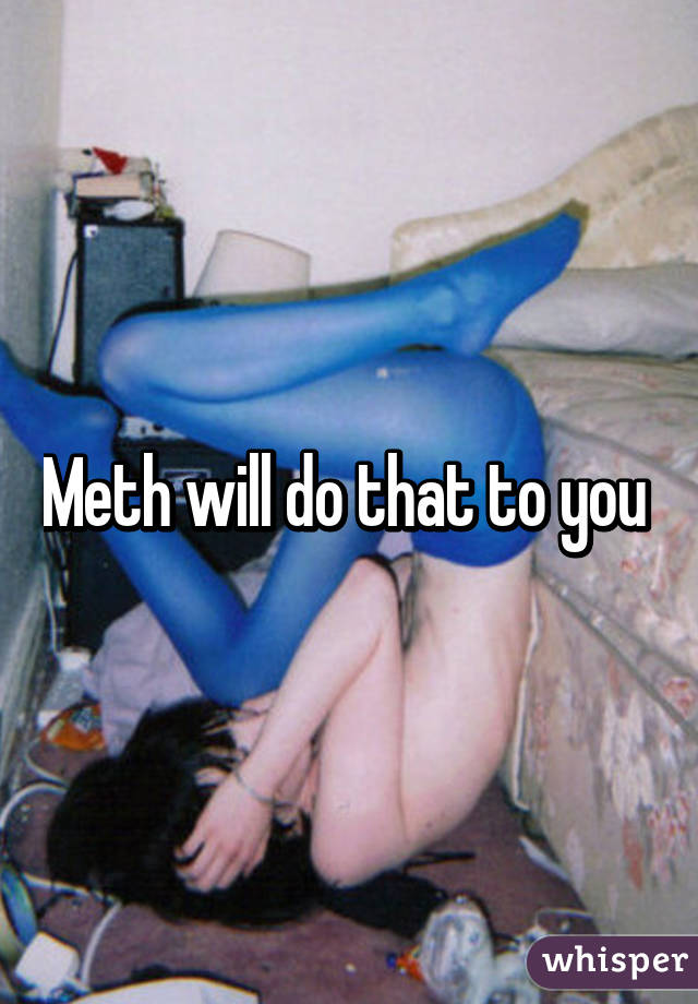 Meth will do that to you 
