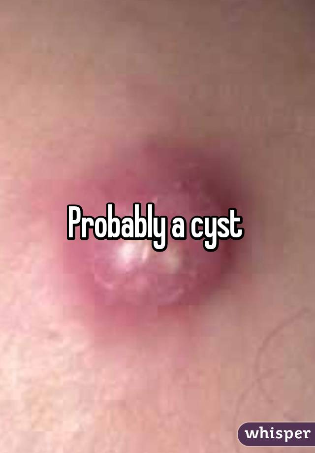 Probably a cyst 