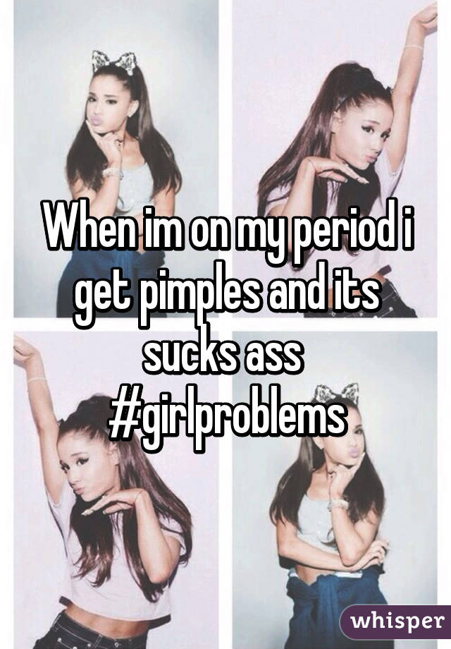 When im on my period i get pimples and its sucks ass 
#girlproblems
