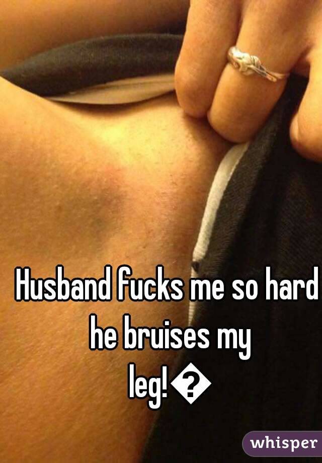 Husband fucks me so hard he bruises my leg!😀