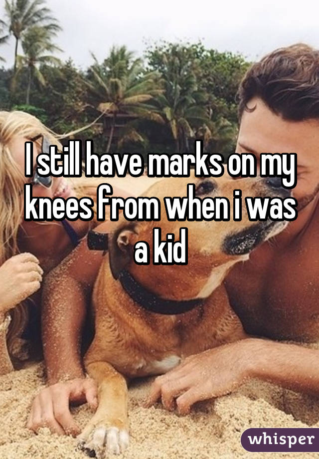 I still have marks on my knees from when i was a kid
