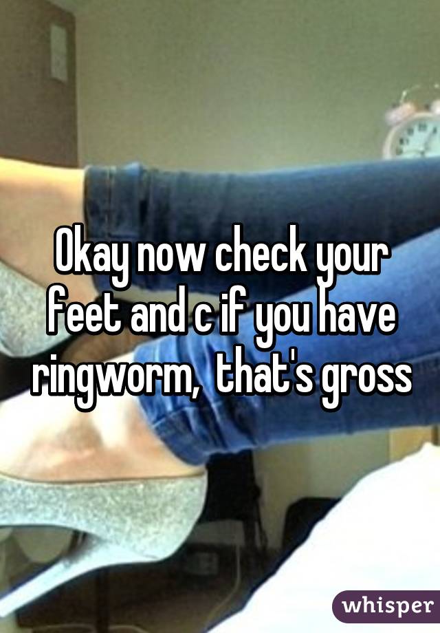 Okay now check your feet and c if you have ringworm,  that's gross