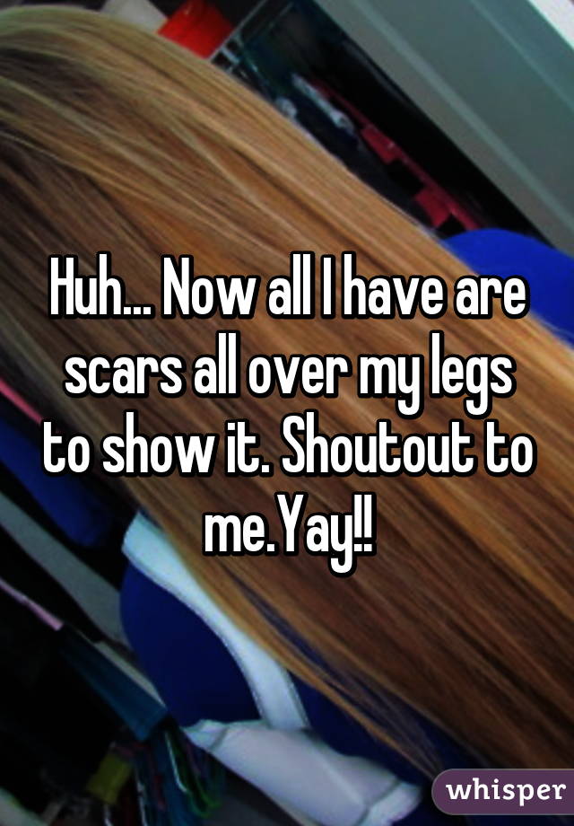 Huh... Now all I have are scars all over my legs to show it. Shoutout to me.Yay!!