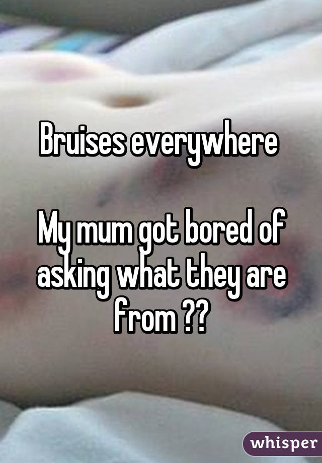 Bruises everywhere 

My mum got bored of asking what they are from 😭😂