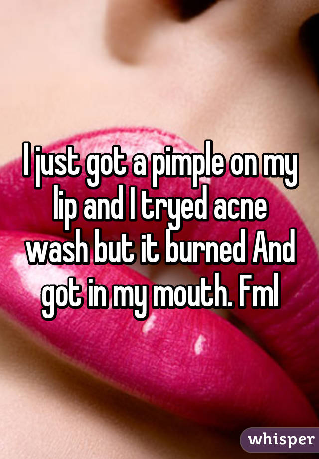 I just got a pimple on my lip and I tryed acne wash but it burned And got in my mouth. Fml