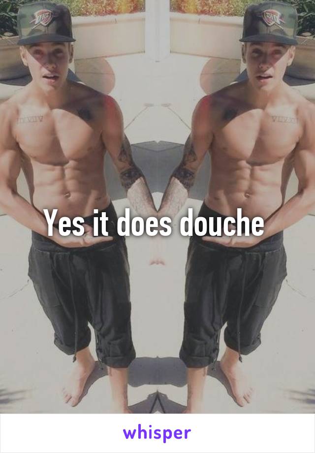 Yes it does douche 