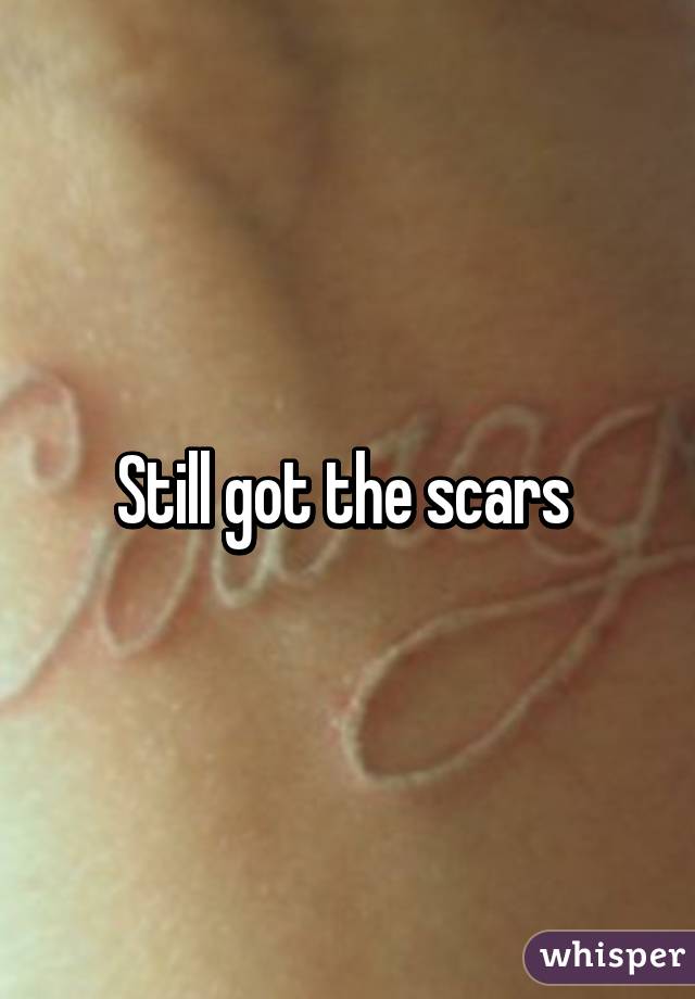 Still got the scars 