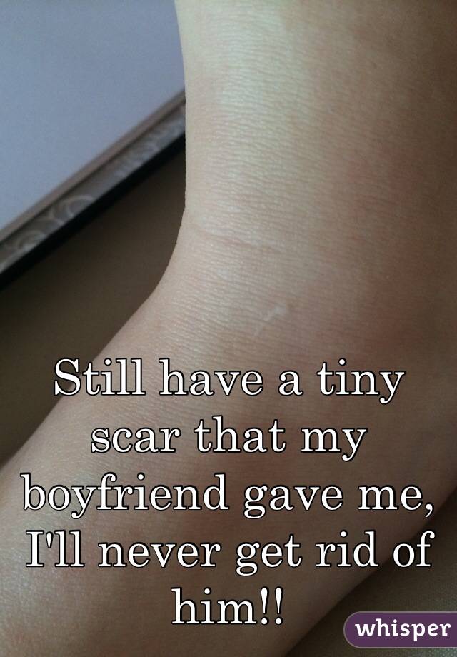 Still have a tiny scar that my boyfriend gave me, I'll never get rid of him!!