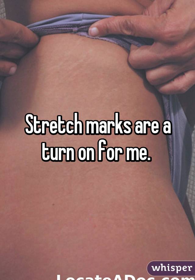 Stretch marks are a turn on for me. 