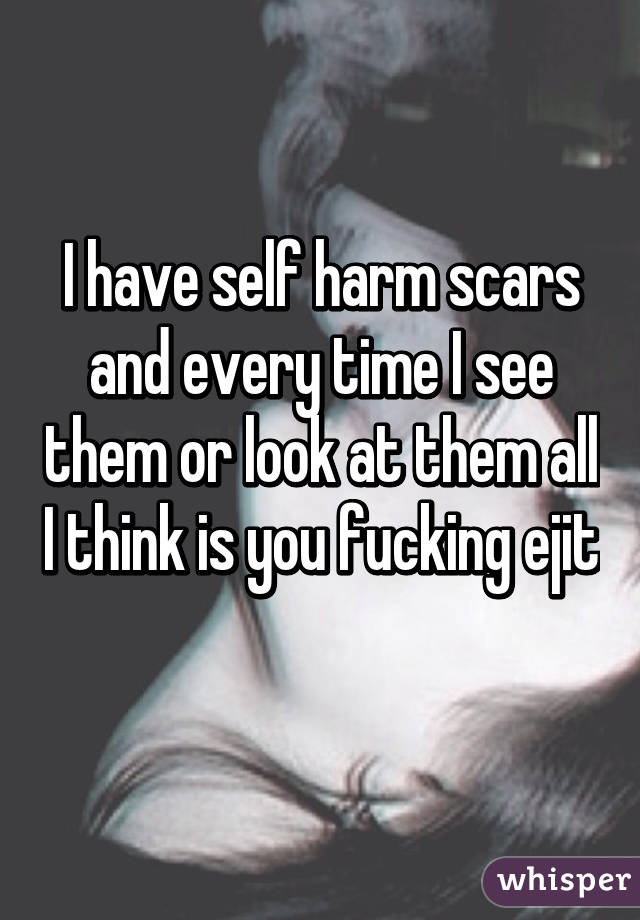 I have self harm scars and every time I see them or look at them all I think is you fucking ejit 