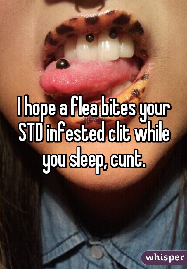 I hope a flea bites your STD infested clit while you sleep, cunt.