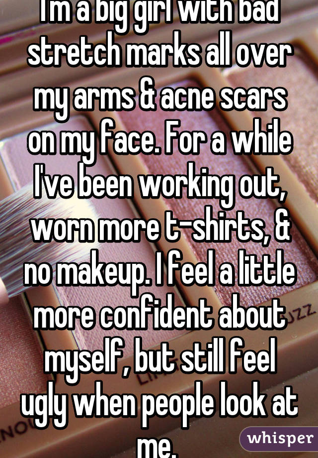 I'm a big girl with bad stretch marks all over my arms & acne scars on my face. For a while I've been working out, worn more t-shirts, & no makeup. I feel a little more confident about myself, but still feel ugly when people look at me. 