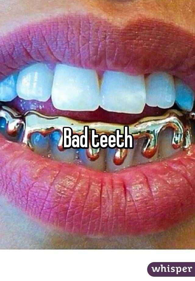 Bad teeth