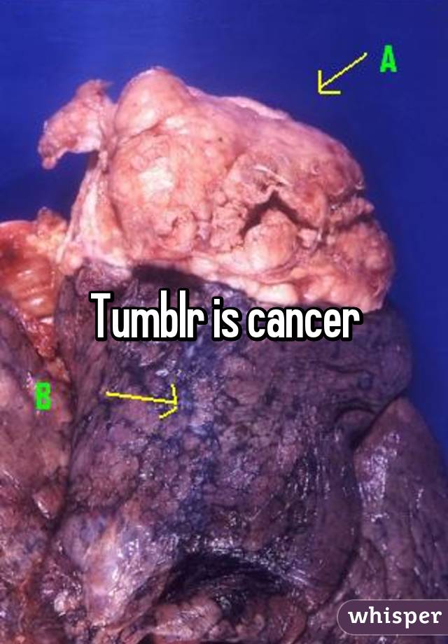 Tumblr is cancer