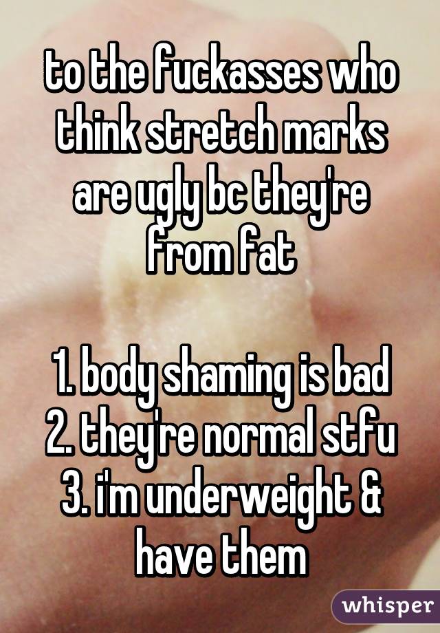 to the fuckasses who think stretch marks are ugly bc they're from fat

1. body shaming is bad
2. they're normal stfu
3. i'm underweight & have them