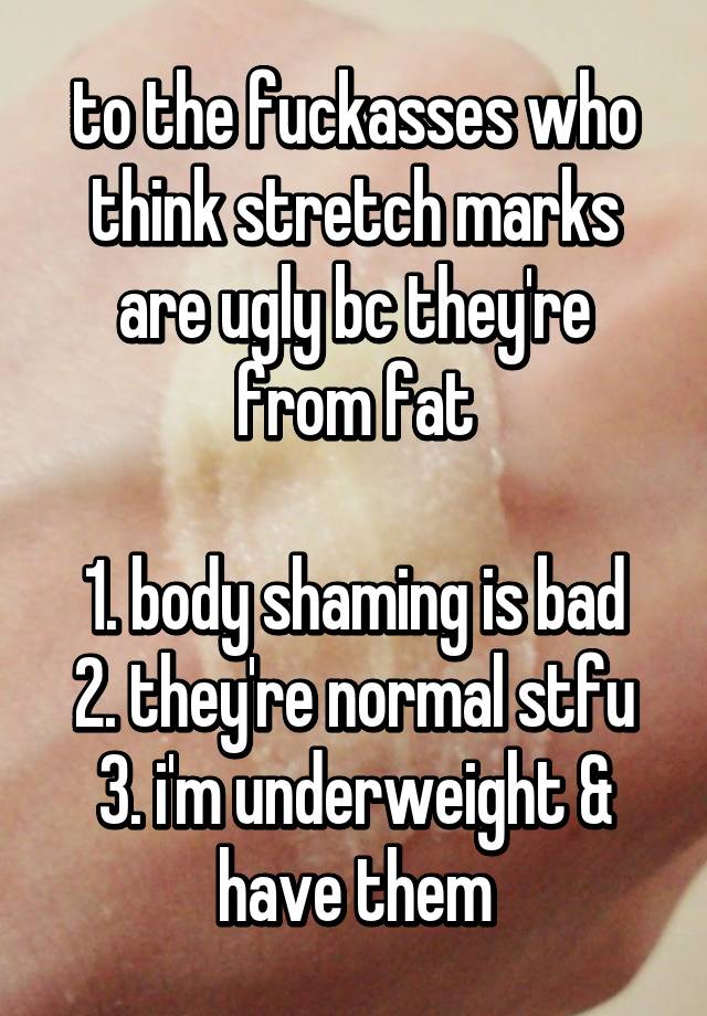 to the fuckasses who think stretch marks are ugly bc they're from fat

1. body shaming is bad
2. they're normal stfu
3. i'm underweight & have them