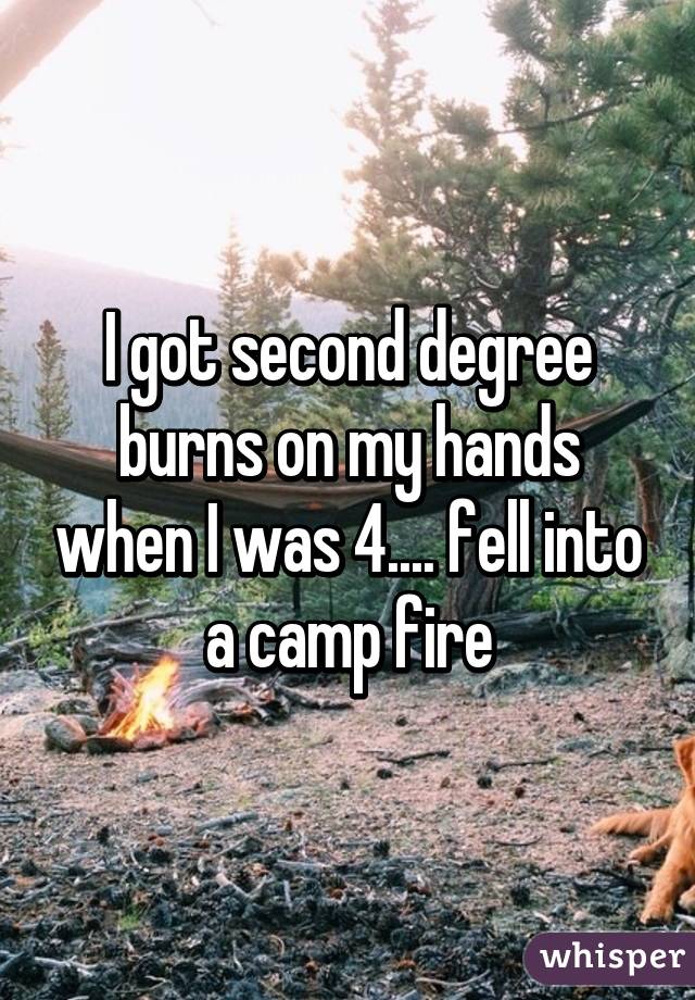 I got second degree burns on my hands when I was 4.... fell into a camp fire