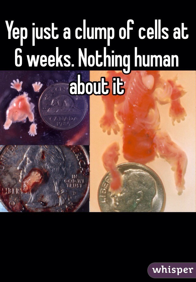 Yep just a clump of cells at 6 weeks. Nothing human about it