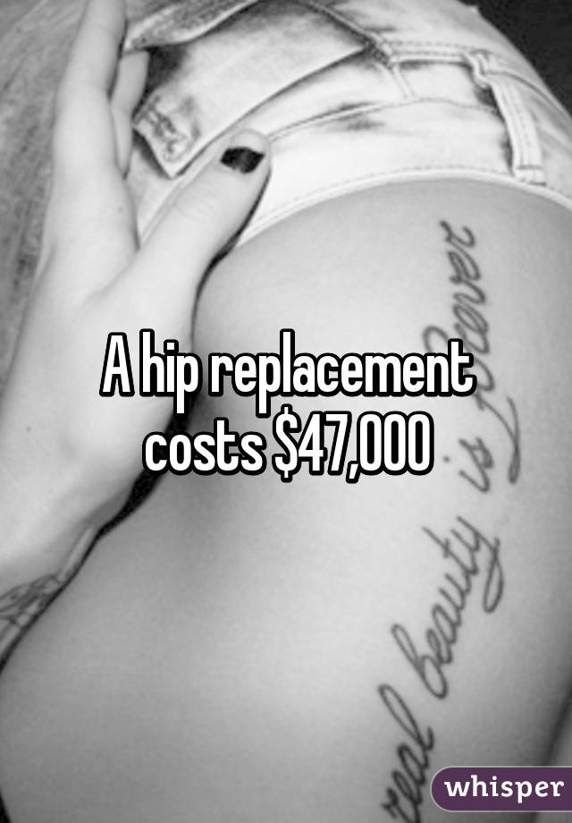 A hip replacement costs $47,000