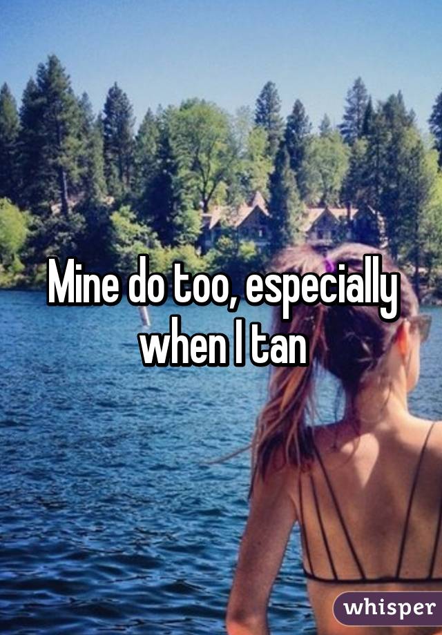 Mine do too, especially when I tan