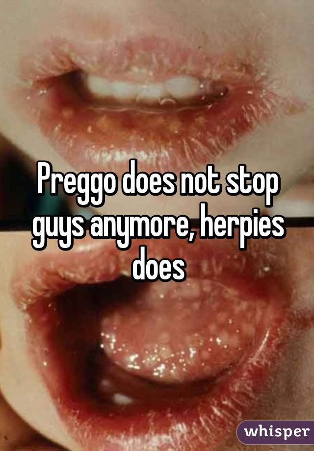 Preggo does not stop guys anymore, herpies does