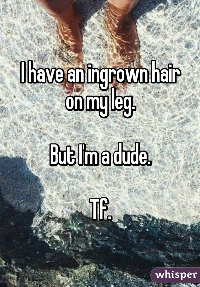 I have an ingrown hair on my leg.

But I'm a dude.

Tf.