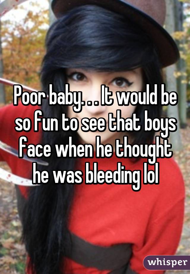 Poor baby. . . It would be so fun to see that boys face when he thought he was bleeding lol