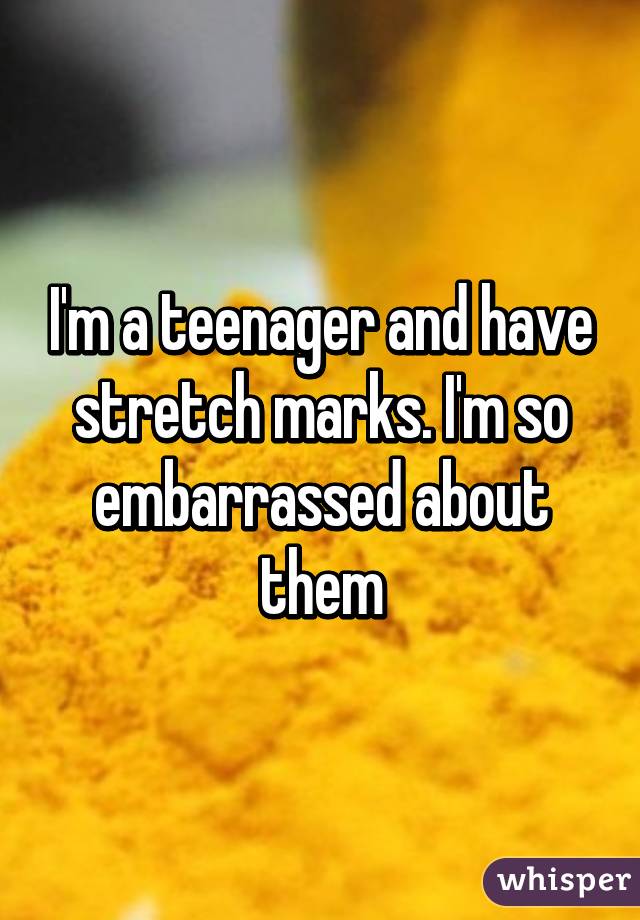 I'm a teenager and have stretch marks. I'm so embarrassed about them