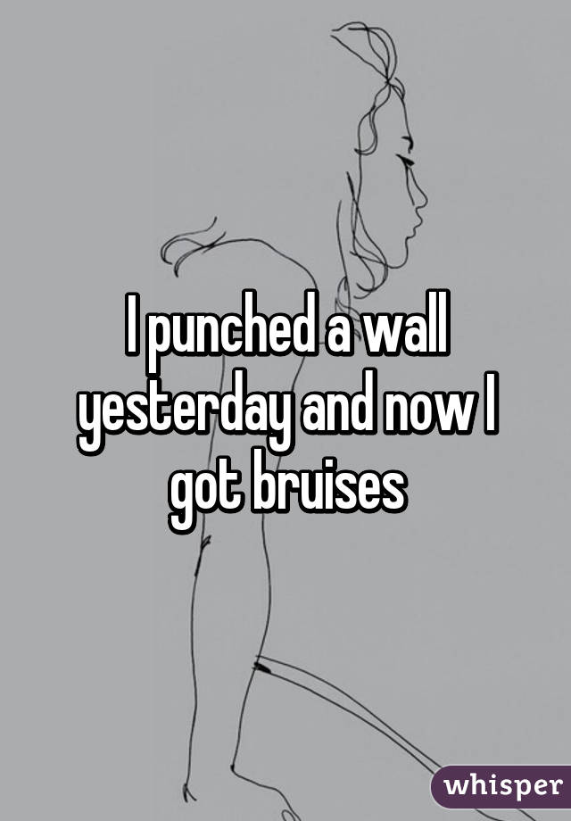 I punched a wall yesterday and now I got bruises