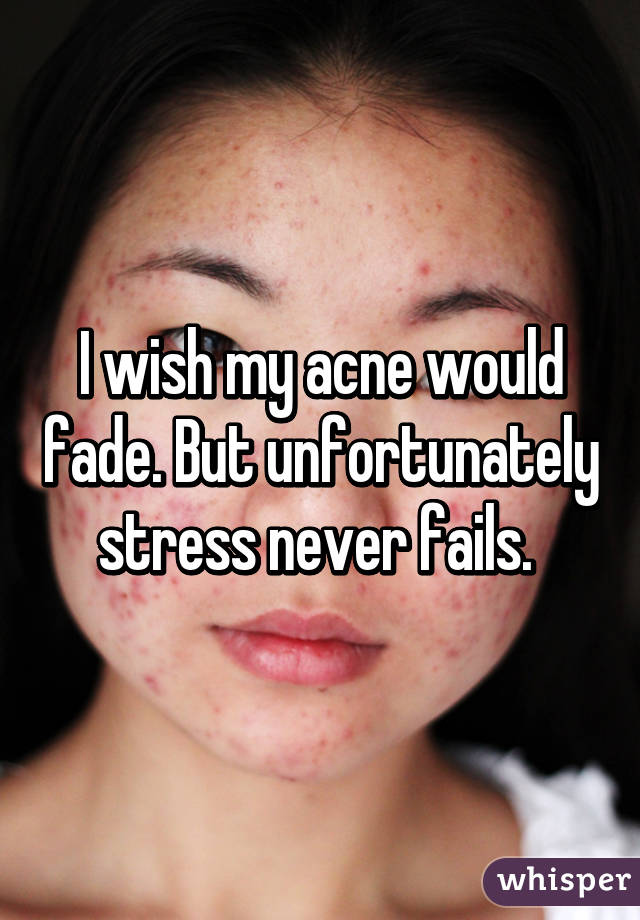 I wish my acne would fade. But unfortunately stress never fails. 