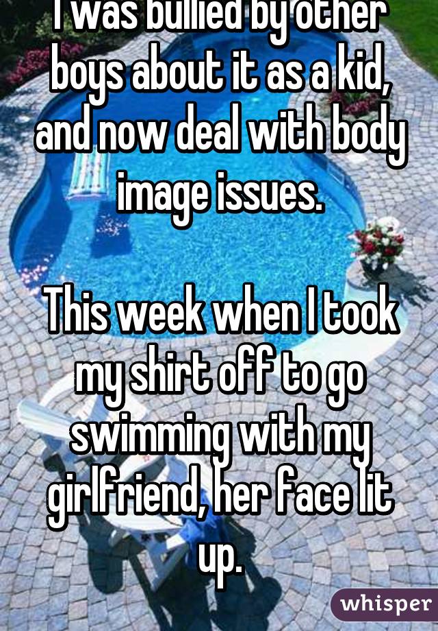 I was bullied by other boys about it as a kid, and now deal with body image issues.

This week when I took my shirt off to go swimming with my girlfriend, her face lit up.
