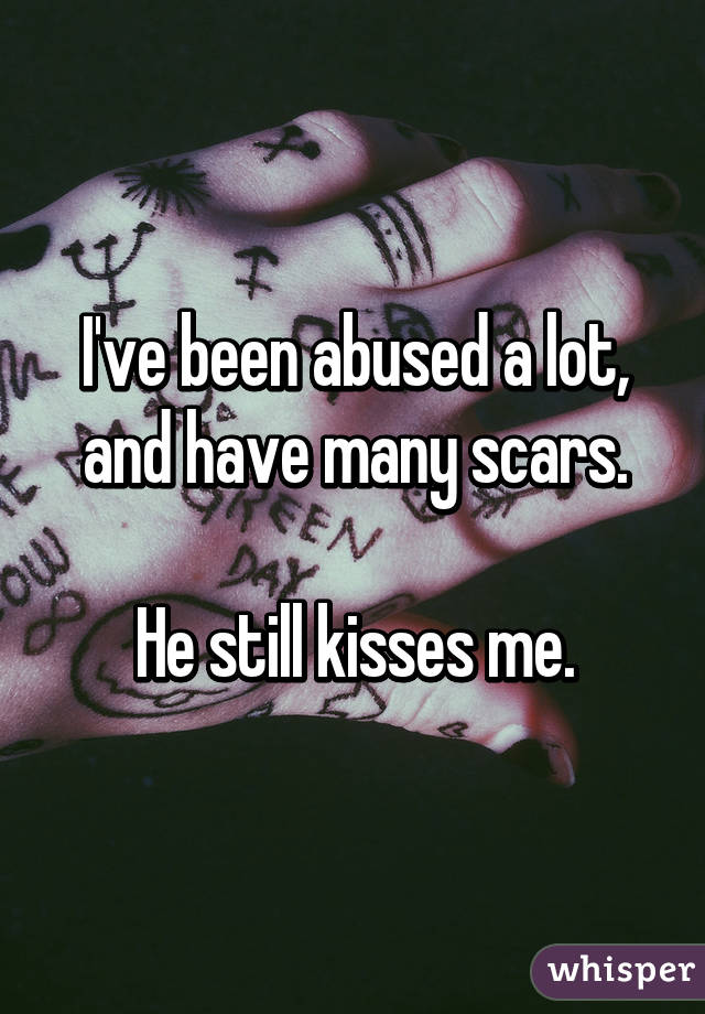 I've been abused a lot, and have many scars.

He still kisses me.
