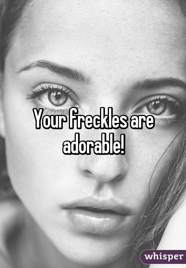 Your freckles are adorable!