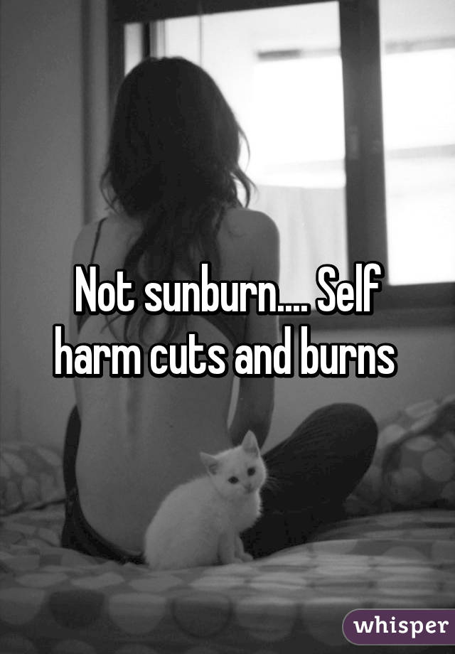 Not sunburn.... Self harm cuts and burns 