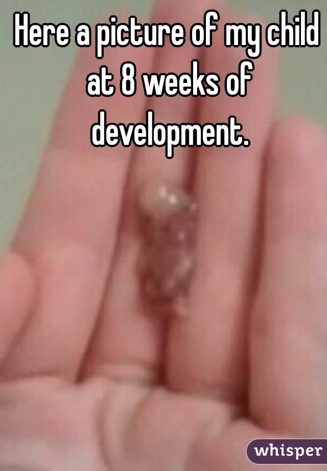 Here a picture of my child at 8 weeks of development.