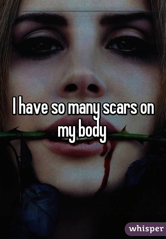 I have so many scars on my body 