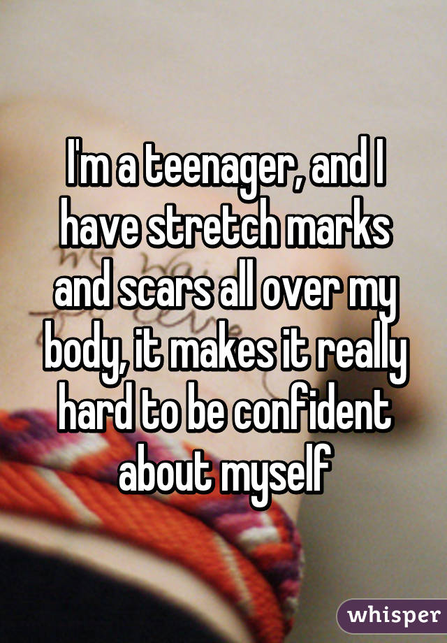 I'm a teenager, and I have stretch marks and scars all over my body, it makes it really hard to be confident about myself