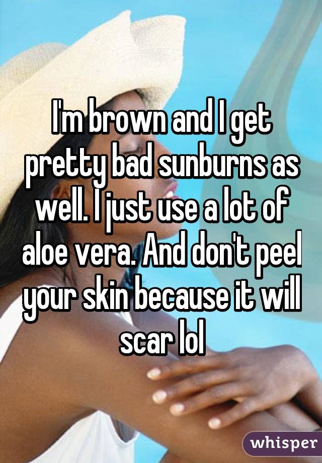 I'm brown and I get pretty bad sunburns as well. I just use a lot of aloe vera. And don't peel your skin because it will scar lol