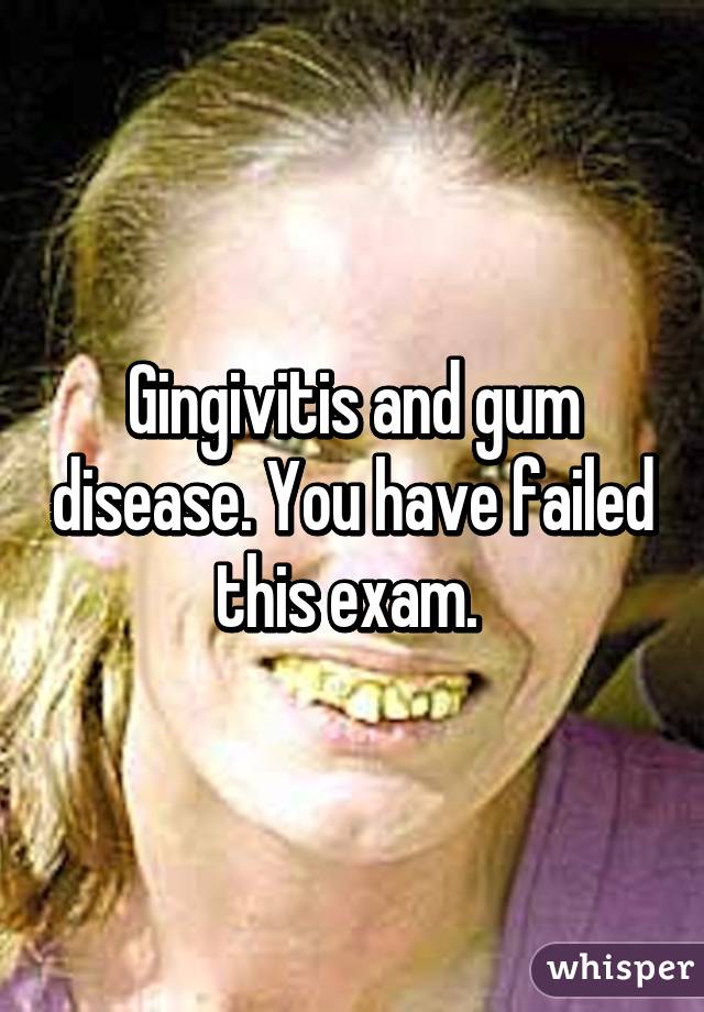 Gingivitis and gum disease. You have failed this exam. 