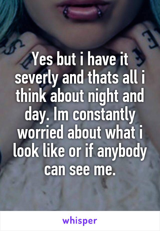 Yes but i have it severly and thats all i think about night and day. Im constantly worried about what i look like or if anybody can see me.