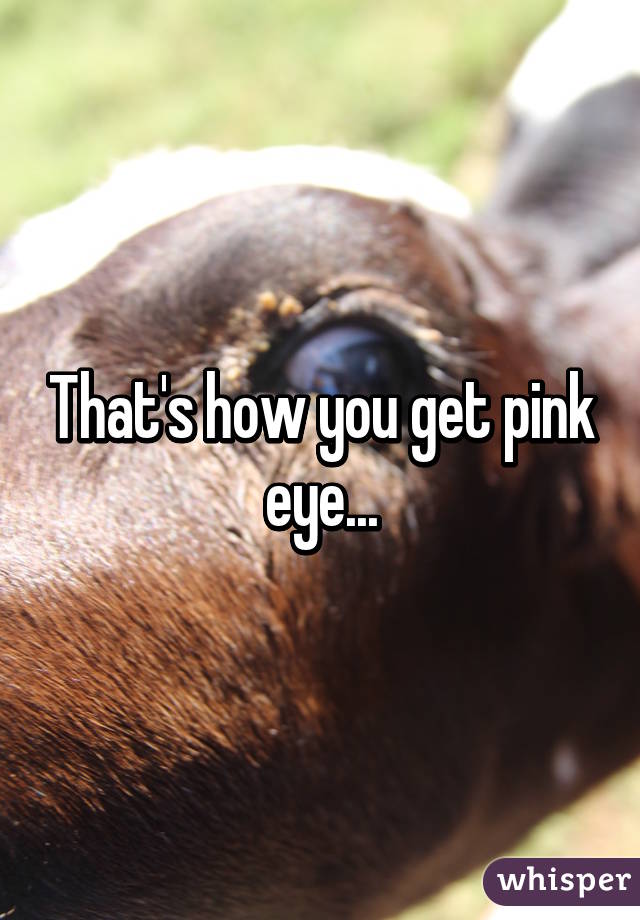 That's how you get pink eye...