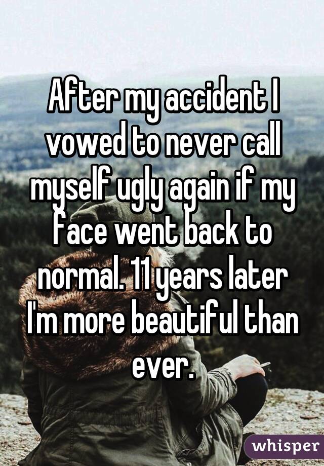 After my accident I vowed to never call myself ugly again if my face went back to normal. 11 years later I'm more beautiful than ever.