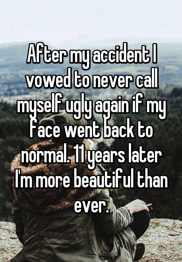 After my accident I vowed to never call myself ugly again if my face went back to normal. 11 years later I'm more beautiful than ever.