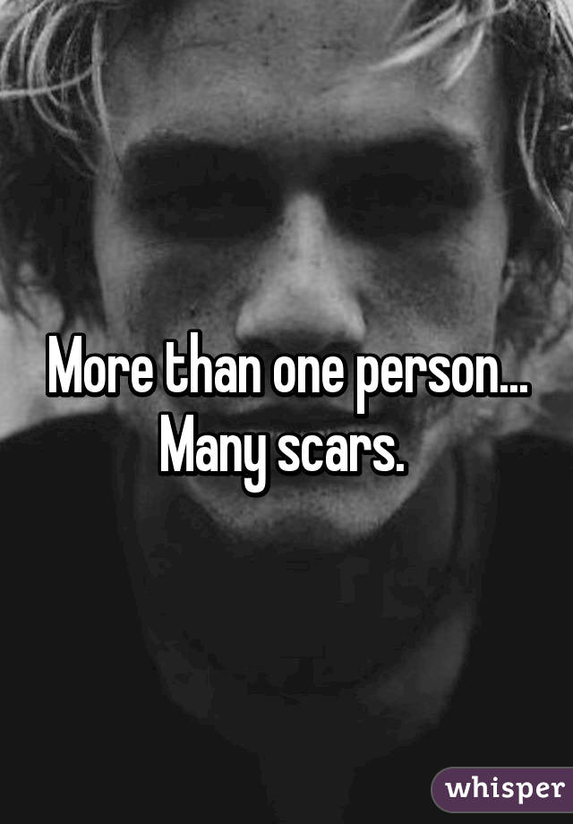 More than one person... Many scars. 