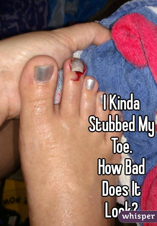 I Kinda
Stubbed My
Toe.
How Bad
Does It
Look?
