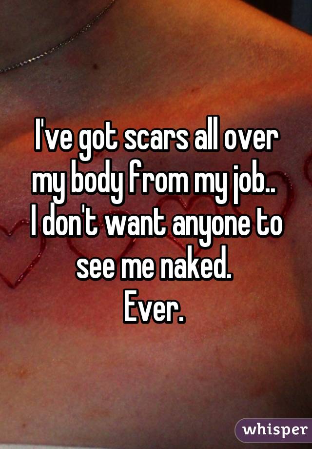 I've got scars all over my body from my job.. 
I don't want anyone to see me naked. 
Ever. 