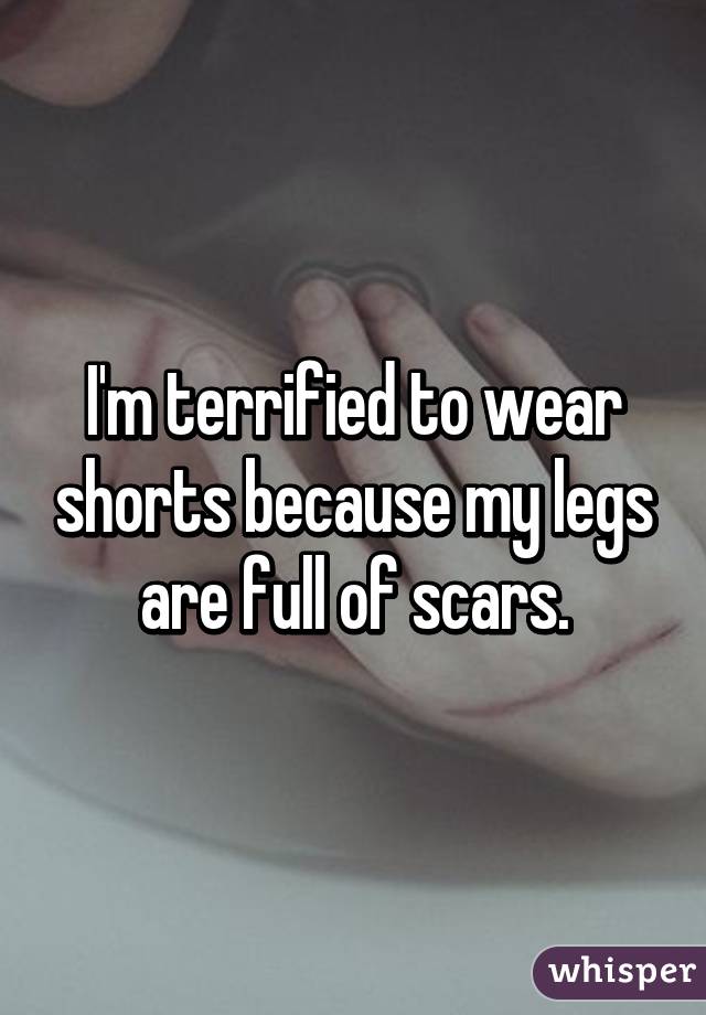 I'm terrified to wear shorts because my legs are full of scars.