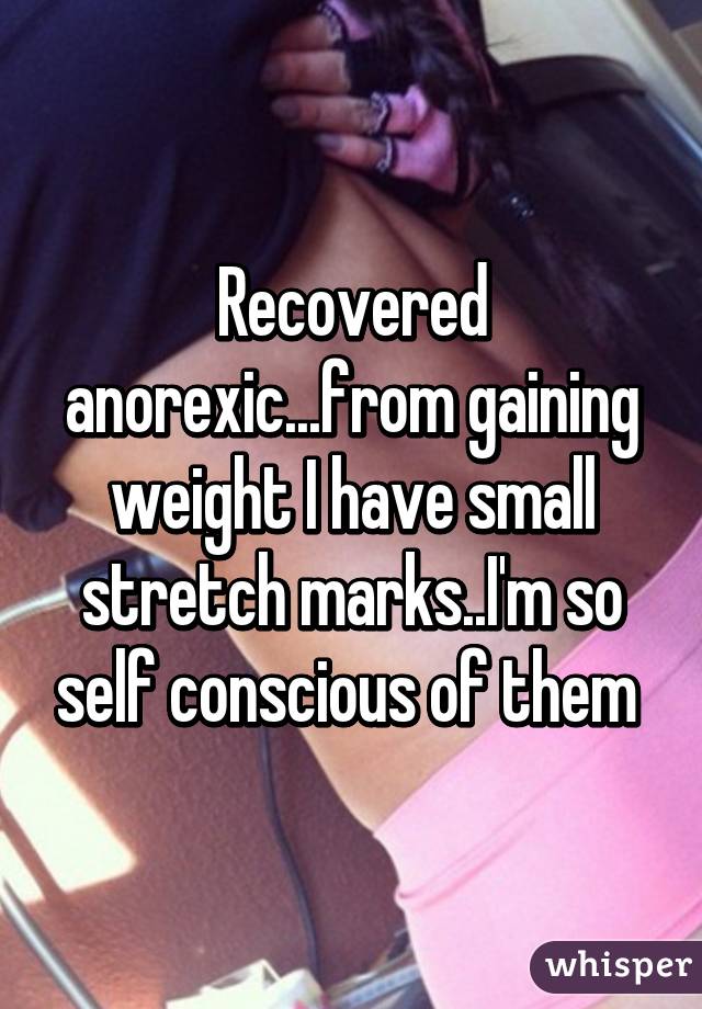 Recovered anorexic...from gaining weight I have small stretch marks..I'm so self conscious of them 